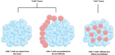 Radiotherapy plus immune checkpoint inhibitor in prostate cancer